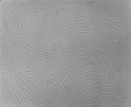 Fibroblasts