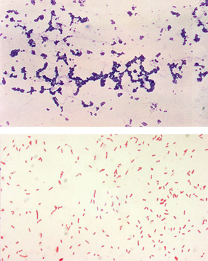 gram negative rods and gram positive cocci