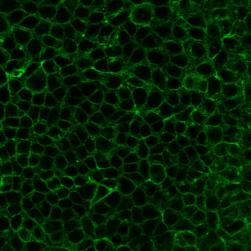 f -肌动蛋白在乳腺癌上皮细胞中的表达