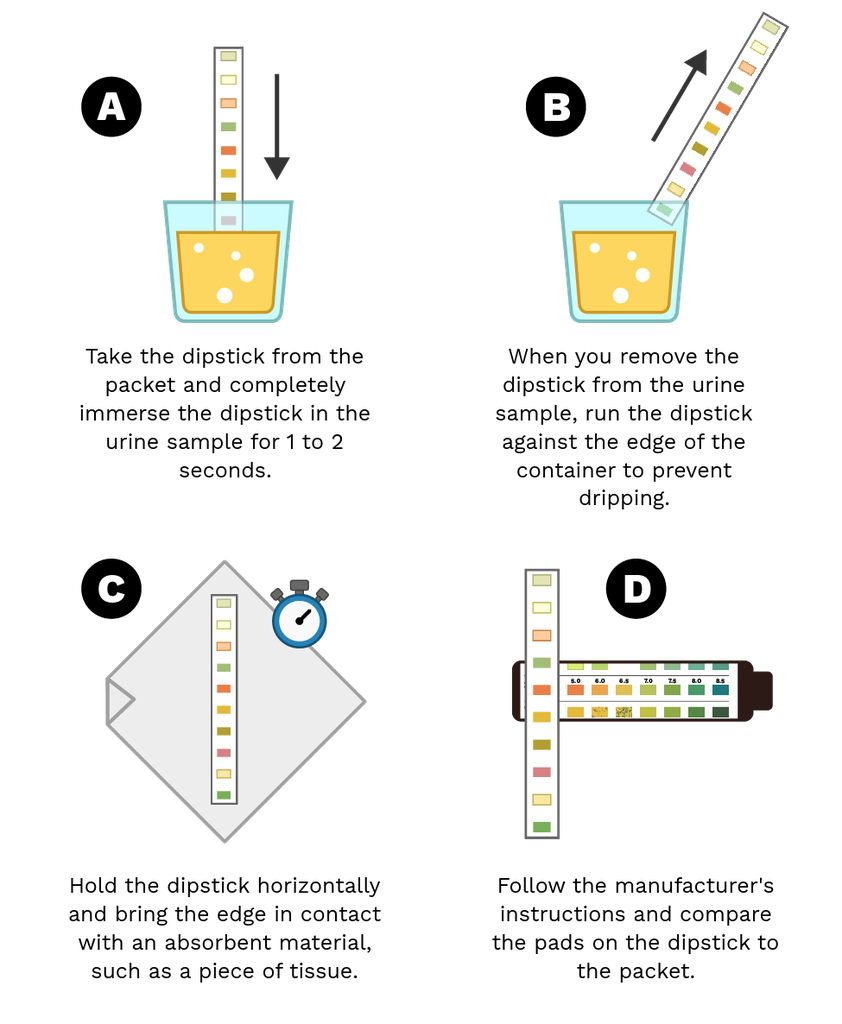 Dipstick Test For Urine Labster